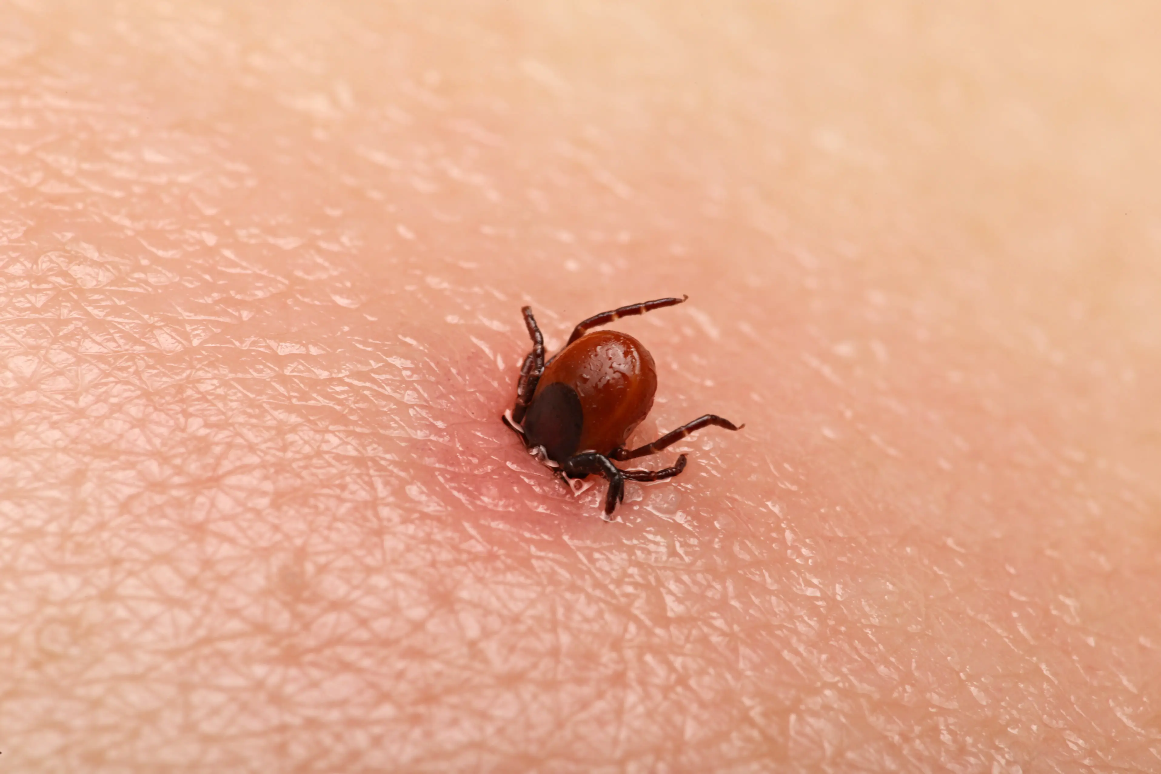 Tick found on human skin after outdoor activity
